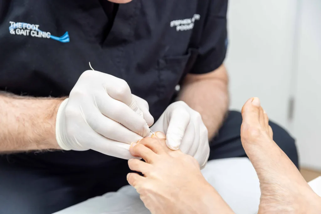 FootGaitClinic web 87
